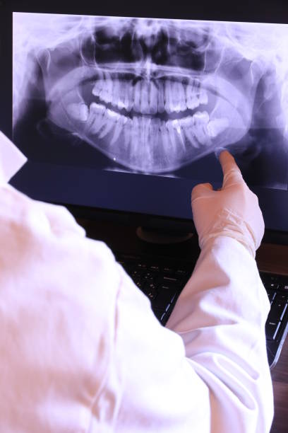 Best Emergency Tooth Extraction in Saddle River, NJ
